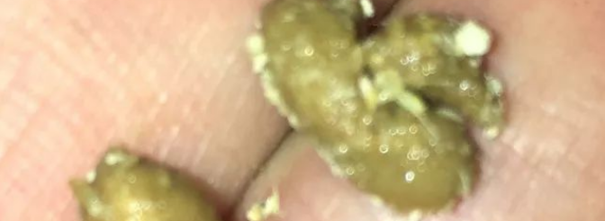 竹鼠肠炎症状:表面有液体,比正常粪便要臭,粘性重